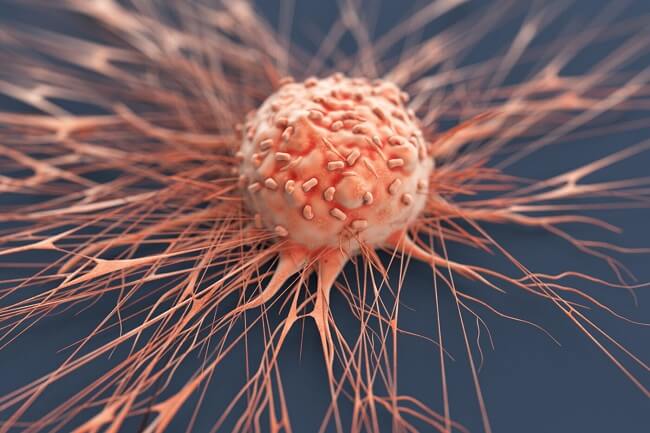 7 loại ung thư có khả năng chữa khỏi cao nhất
