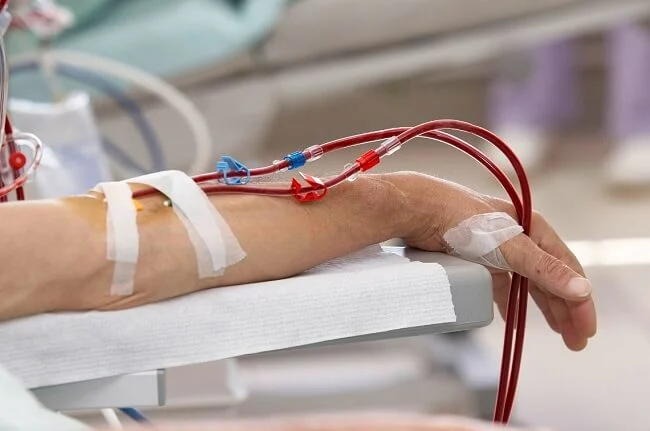 Truyền máu cho người bị suy giảm công thức máu