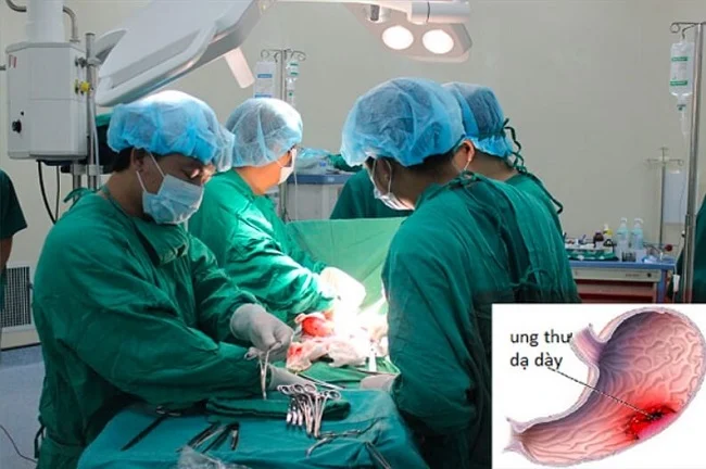 Phẫu thuật cắt bỏ 1 phần hoặc toàn bộ dạ dày