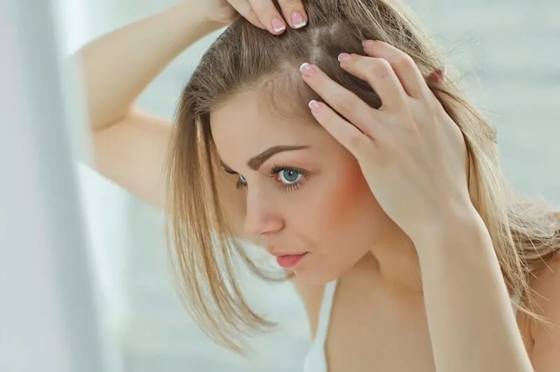 Rụng tóc sau xạ trị