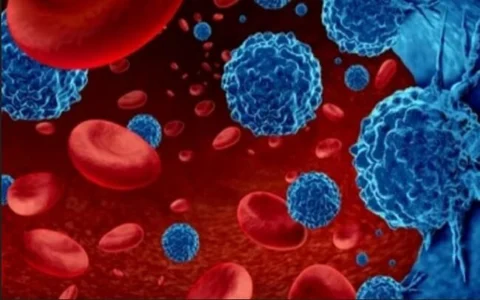 Tế bào ung thư dạ dày có thể theo máu lây lan tới gan